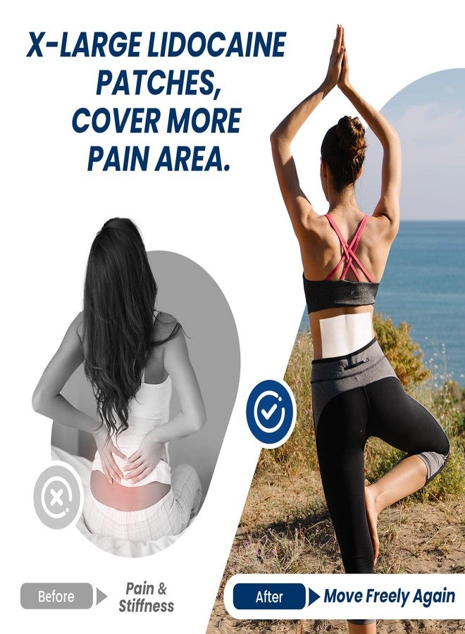 سوميفون لصقات سوميفن إكس إل ليدوكايين لتسكين الألم، 4% ليدوكايين أقصى قوة بدون وصفة طبية، حجم كبير جدًا 4.72 بوصة × 7.87 بوصة للصقات آلام الظهر الكاملة والمناطق الكبيرة (حجم كبير جدًا، العدد، 26) - Image 4